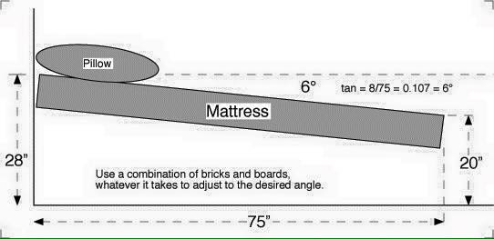 6 degree drawing of an inclined bed modification